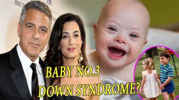 George Clooney's Twins With Down Syndrome: A Story Of Love And Resilience
