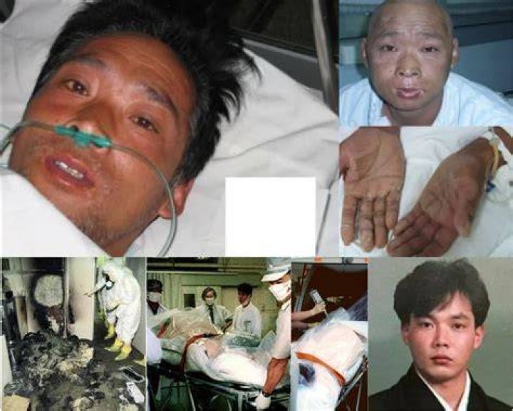 Hisashi Ouchi's True Picture: An Unforgettable Look At Radiation's Devastating Effects