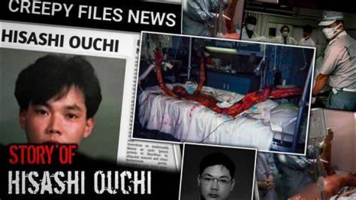 Horrific Hisashi Ouchi Images: A Cautionary Tale