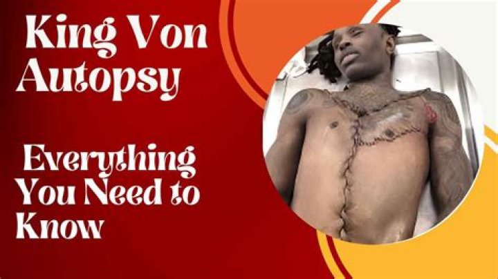 King Von Autopsy Exposed: Shocking Images Revealed