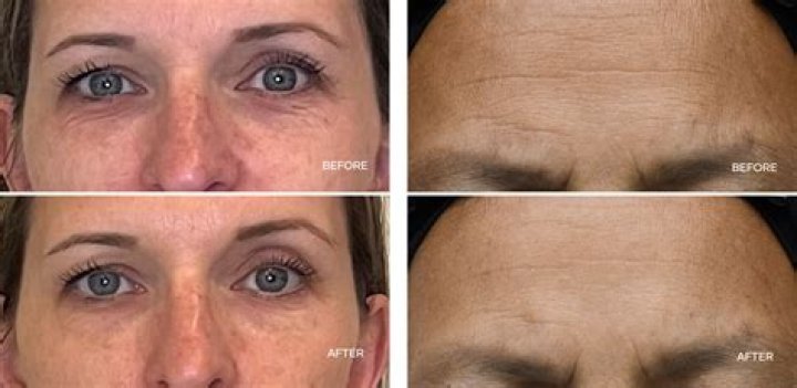 The Ageless Beauty And Her Journey To Youthful Radiance
