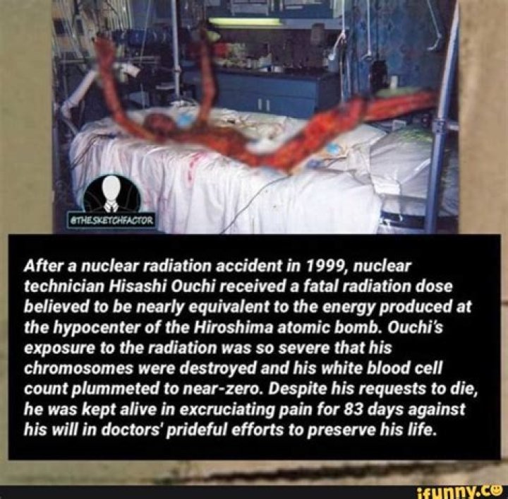 The Devastating Aftermath: Hisashi Ouchi's Photos Reveal The True Horrors Of Radiation Exposure