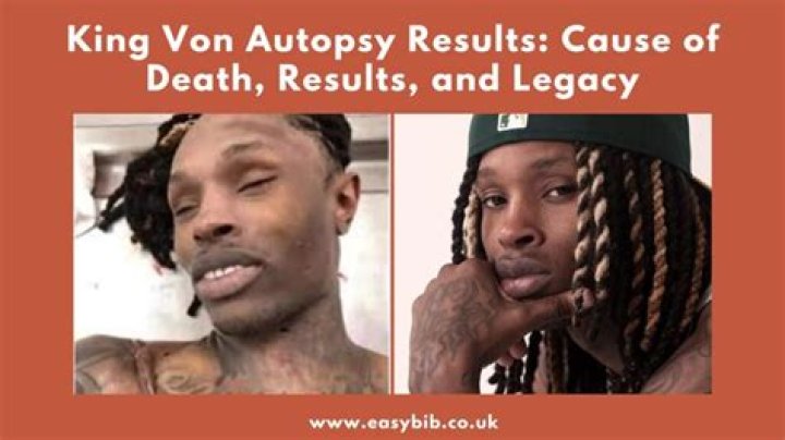 The Shocking Truth: King Von's Autopsy Report Revealed