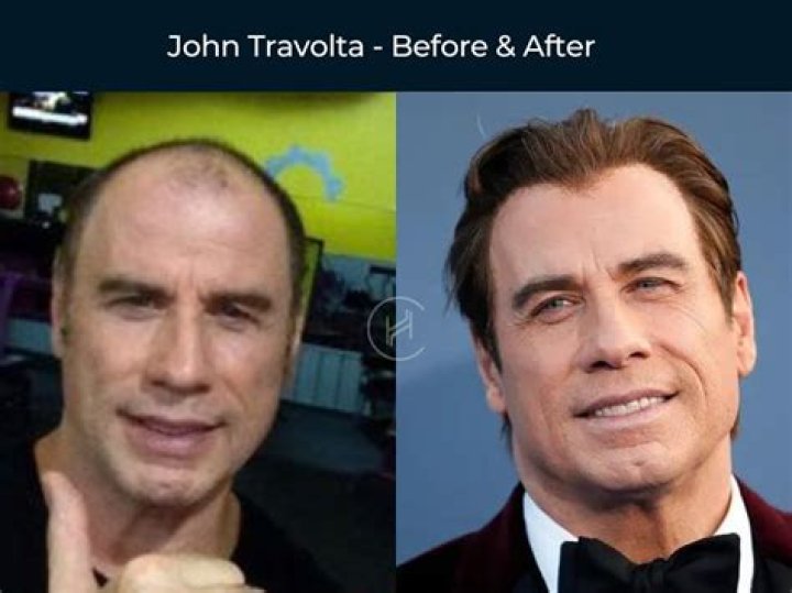 The Weighty Journey Of John Travolta ·