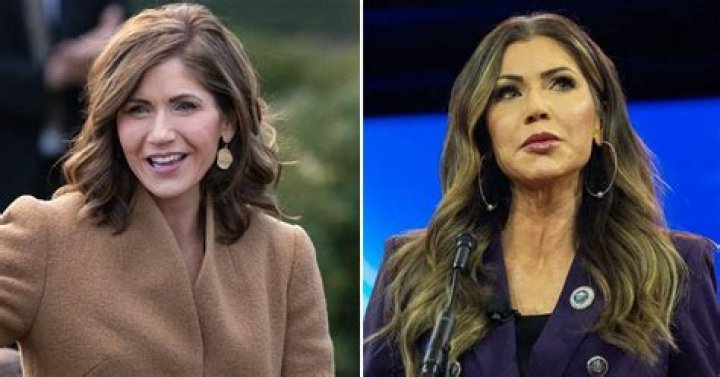 Unveiling The Journey: Kristi Noem's Alleged Plastic Surgery Transformation