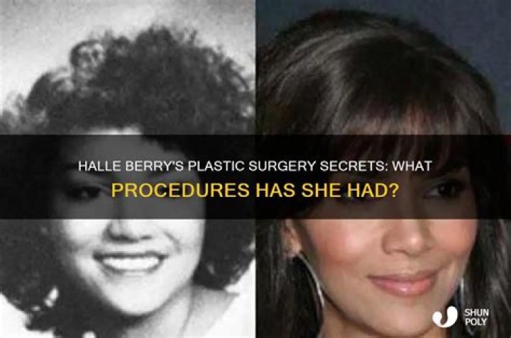 What Procedures Has She Had?